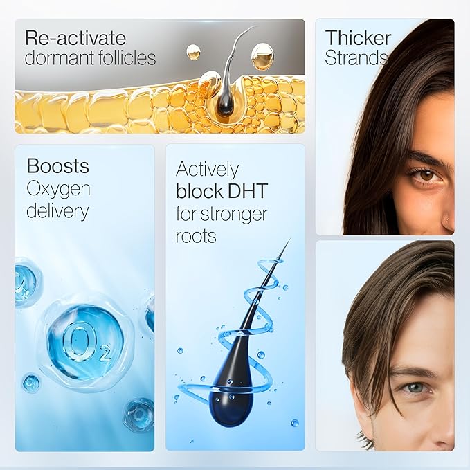 Be Bodywise Rosemary Hair Growth Serum Roll On 50 ml – 3% Rosemary, 3% Redensyl & 2% Anagain | DHT-Blocking Scalp Serum Boosts Oxygen Flow, Reduces Hair Fall | Paraben/Sulfate-Free | Women & Men