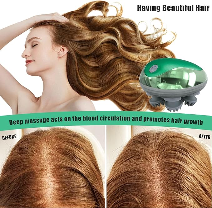 Electric Scalp Massager, Head Massage Scalp with 4 Removable Massage Claws, Rechargeable,Promotes Hair Growth, Relieves Stress, Waterproof, Portable Handheld Head Massager,Gift