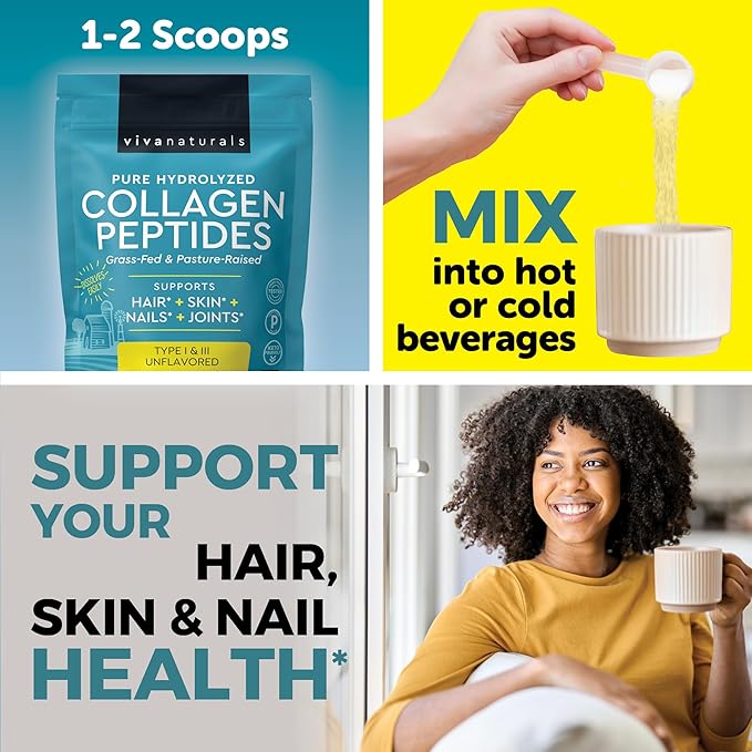 Viva Naturals Hydrolyzed Collagen Peptides Powder, 1 lb – Grass-Fed & Pasture-Raised Bovine Collagen, Type I & III, Unflavored Powder for Hair, Skin & Nails
