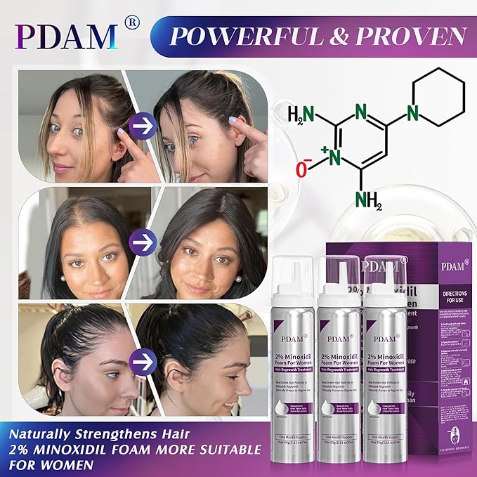Minoxidil for Women Foam Hair Growth - Minoxidil Hair Regrowth Treatment for Women, Topical Solution Hair Loss Treatments, Thicker and Fuller Hair, 3-Month Supply, 3 x 2.11 oz