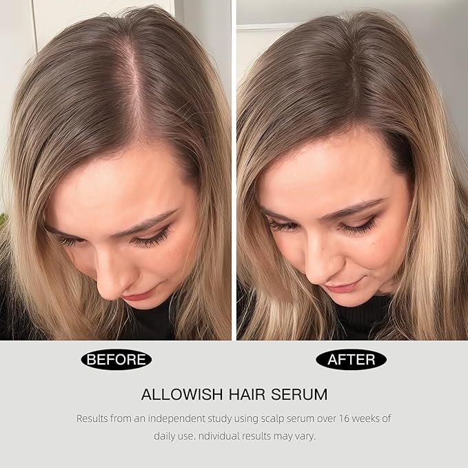 Hair Growth Serum 95 ml - Rosemary Hair Thickening Serum with Biotin, Caffeine for Hair Thinning & Shedding – Promotes Healthy Scalp, Fuller, Nourish, Strengthens Roots