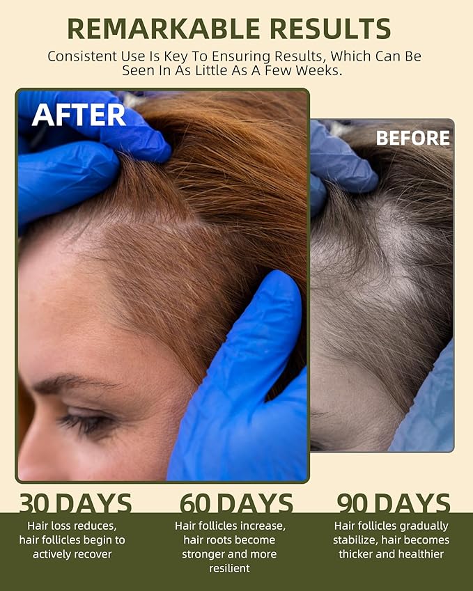 100% Natural Raw Batana Oil for Hair Growth, Dr Sebi Hair Growth Oil From Honduras, Thicker & Stronger Hair, Prevents Hair Loss, Eliminates Split Ends 4.23 Fl Oz (Pack of 1)