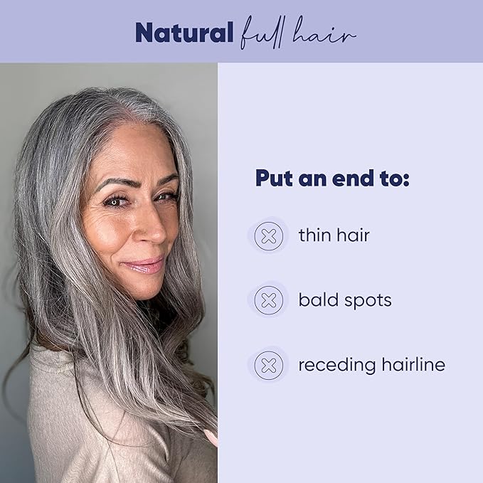 MOERIE Ultimate Hair Growth Serum for Natural Hair Regrowth & Thickening - Anti Thinning & Hair Loss Treatment for Women - Rapid Hair Growth Products - Scalp Oil Alternative - 1.69 fl oz / 50 ml