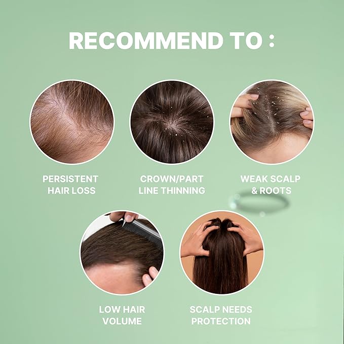 Korean Scalp Intensive Hair Growth Serum｜Biotin & Panthenol Leave-In Ampoule for Hair Loss, Thinning Hair, Scalp Hydration & Strengthening (2.02 fl oz)