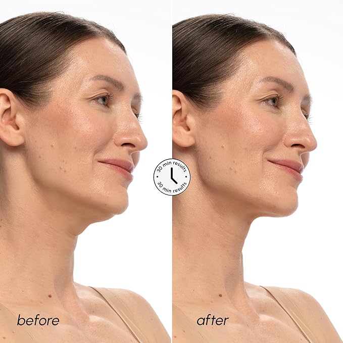 MAREE V Line Lifting Mask with PDRN Salmon DNA – Deep Collagen Face Mask for Women – Jawline Shaper Facial Masks with Retinol – Tightening & Firming Neck Lift Tape – Double Chin Strap for Face Lift