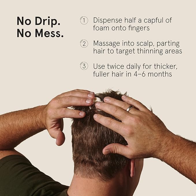 Keeps Extra Strength Minoxidil for Men - 5% Minoxidil Foam Hair Loss & Regrowth Treatment for Thinning & Bald Spots - Clinically Proven Hair Growth Products - Unscented Topical Aerosol Foam