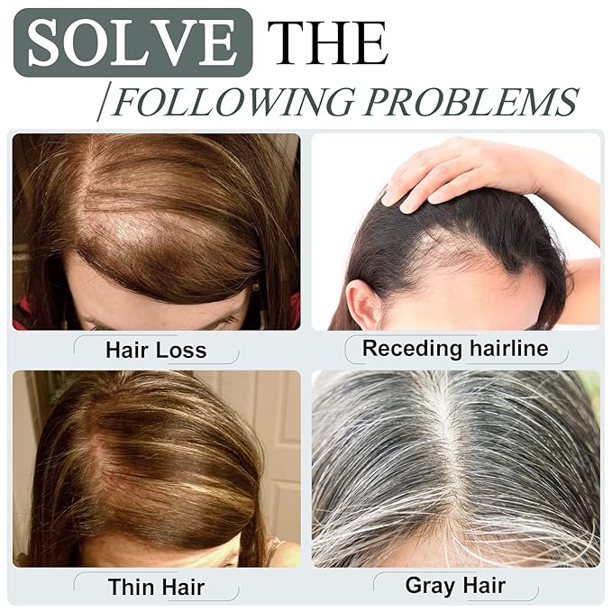 SEGO Hair Toppers for Women Real Human Hair for Thinning Hair, Clip In Topper with Front Bangs, Straight, 150% Density, Silk Base, 8 Inches,#6 Light Brown