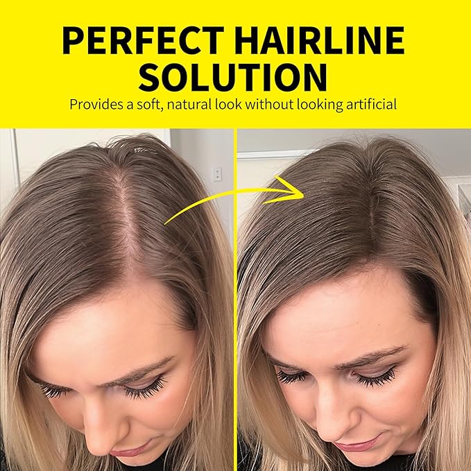Sevich Hairline Powder - Root Touch Up Instantly Hair Color for Thinning Gray Coverage - Bald Spot Concealing Hair Powder for Women & Men - 48Hour Waterproof & Sweatproof - Brown
