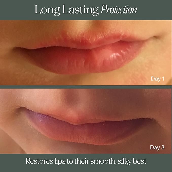 Doctor Rogers Lip Balm, Hydrating and Softening Lip Moisturizer For Very Dry Lips, Dermatologist-Created, Natural, & Hypoallergenic Moisturizing Lip Balms, 4.25g Tube, Pack of 3