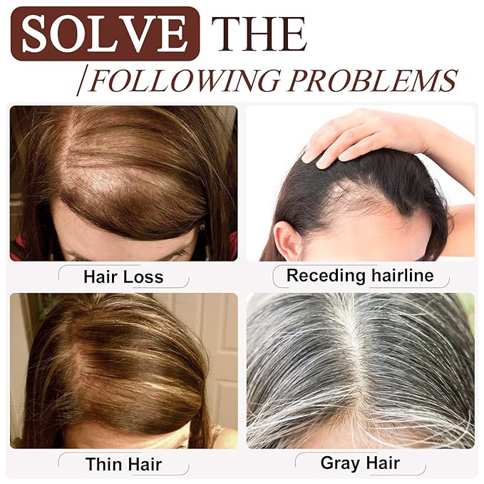 SEGO Real Human Hair Topper for Women, No Bangs Hair Topper with Anti-Slip Clips (6 Inch#4/27 Medium Brown Mix Dark Blonde)