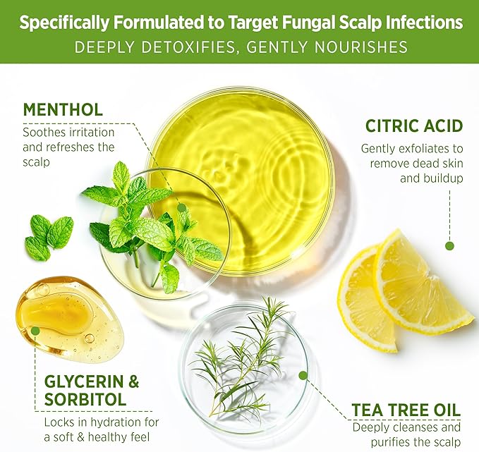 Roycederm Tea Tree Scalp Scrub with Scalp Massager Brush - Deep Cleansing & Exfoliating Pre-Shampoo Treatment for Dry, Flaky Scalp – Gently Refreshes, Hydrates & Balances Scalp