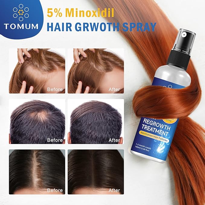 5% Minoxidil Beard Growth Kit: Hair Regrowth treatment – Women and Men Hair Growth kit for Thicker, Fuller Beard & Hair – Stop Hair Loss & Thinning – Minoxidil Hair Growth Serum