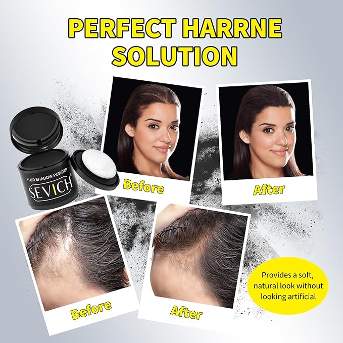 Sevich Hairline Powder 10g 2-Pack with Brush, Instantly Conceals Hair Loss & Thinning, 48H Waterproof Root Touch Up Powder, Natural Hair Shadow Toppers for Women & Men, 2 Box = 5 Boxes,Light Brown