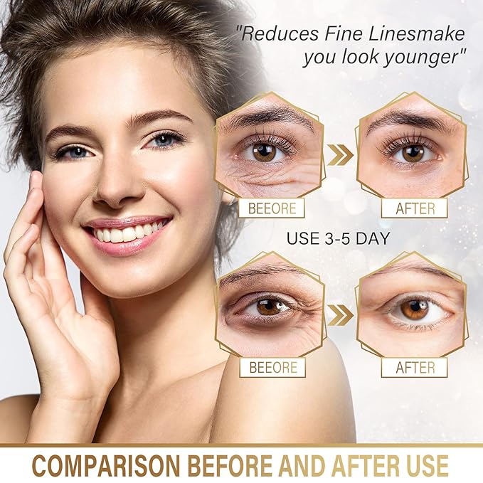 Under Eye Masks - 24K Gold Under Eye Patches for Puffy Eyes and Dark Circles - Under Eye Treatment, Fine Lines & Puffiness, 30 Pairs Collagen Eye Gel Pads for Personal Care