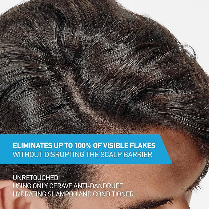 CeraVe Hydrating Anti Dandruff Shampoo, 1% Pyrithione Zinc Dandruff Treatment With Ceramides, Niacinamide & Hyaluronic Acid, Helps Eliminate Flakes & Provides Itchy Scalp Relief, Sulfate Free, 19 Oz