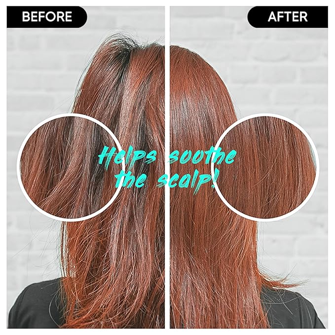 Centella Shampoo Bar 2.0 - Hydrating & Moisturizing Natural Hair Soap Bar Shampoo for Hair & Scalp Nourishment - Bathing Soap Solid Shampoo for All Hair Types (120g, 4.23oz)