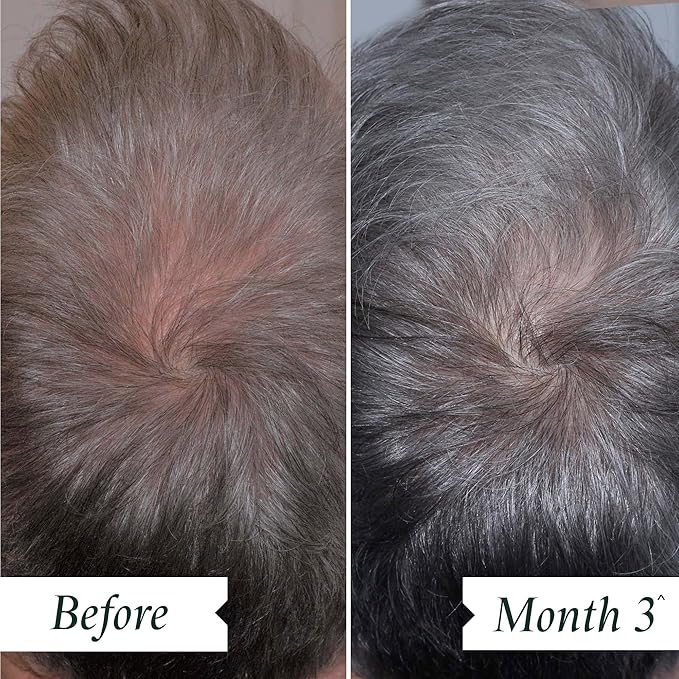 Philip Kingsley Density Preserving Serum for Thinning Hair and Hair Loss, Scalp Care for Hair Fall and Thickness, 2.87 oz
