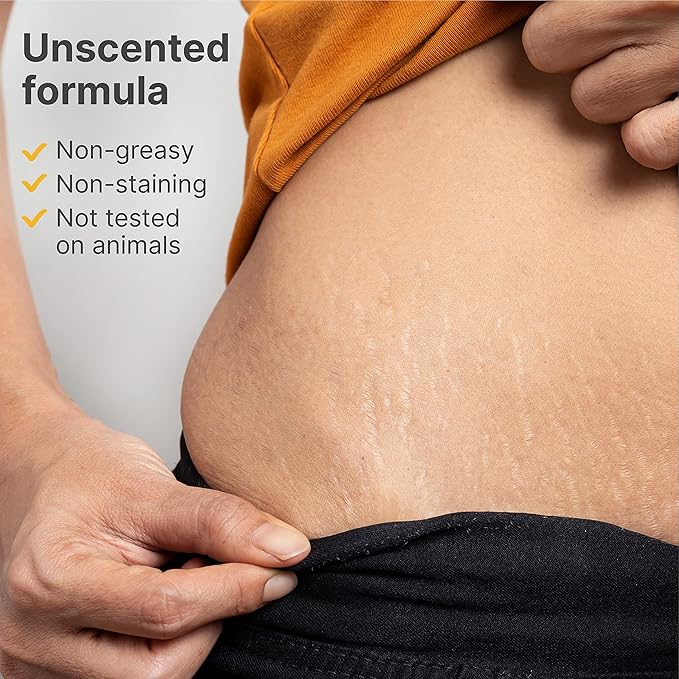 TriLASTIN-SR Intensive Stretch Mark Cream (5.5oz) Bundle with Nipple & Lip Balm (3pk) | Fast-Acting Stretch Marks Cream with Absorption Enhancing Serum | Breastfeeding & Ingesting Safe Balm