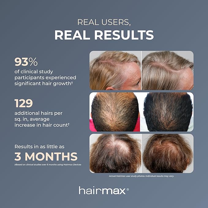 Hairmax Ultima 9 Classic LaserComb -(FDA Cleared) Laser Hair Regrowth Treatment Device for Men & Women - Reverses Thinning Hair Loss - Red Light Therapy to Stimulate Hair Growth - Cordless Design